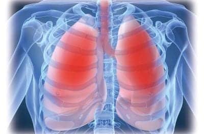 Sleep-disordered Breathing Secondary to Sarcoidosis