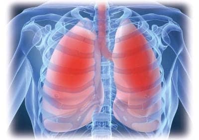 Sleep-disordered Breathing Secondary to Sarcoidosis