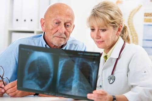 Sleeping Pills Linked to Increased Fatal Pneumonia Risk