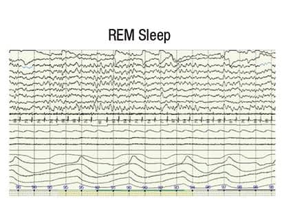 REM Sleep