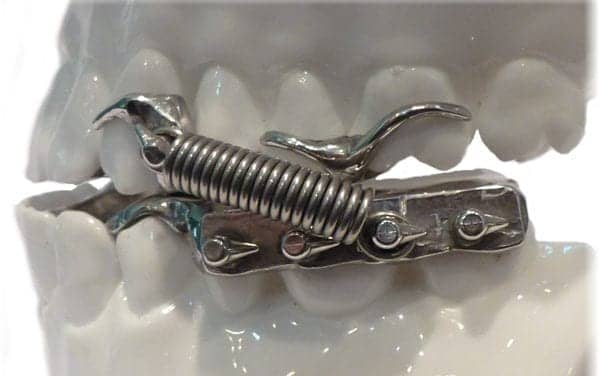 TheraSom Cast for TMJ Sufferers