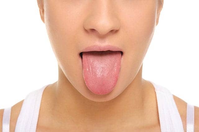 Tongue Size, Fat May Predict Sleep Apnea Risk in Obese Adults