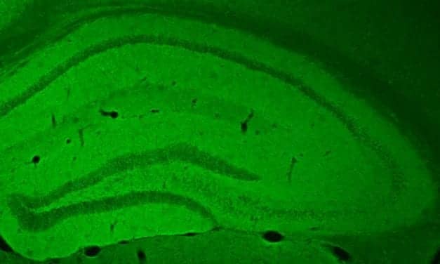 Penn-led Team Prevents Memory Problems Caused by Sleep Deprivation