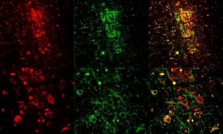 MIT Researchers Use Optogenetics to Trigger REM Sleep in Mice