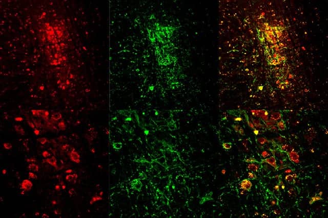 MIT Researchers Use Optogenetics to Trigger REM Sleep in Mice