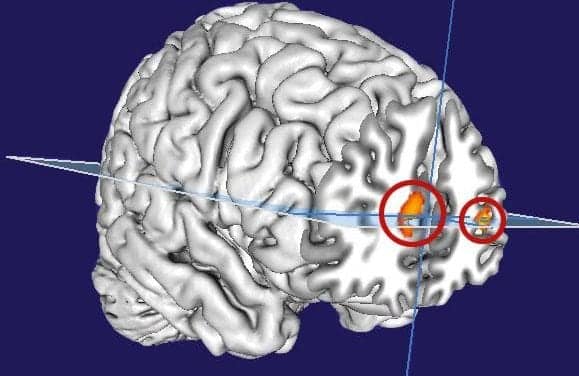 Brain Researchers Discover Similarities Between Dreaming, Wakefulness