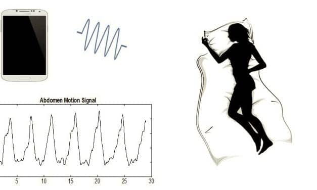 ApneaApp Detects Sleep Apnea Via Smart Phone With 95% to 99% Accuracy
