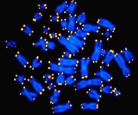 PTSD Linked to Accelerated Aging