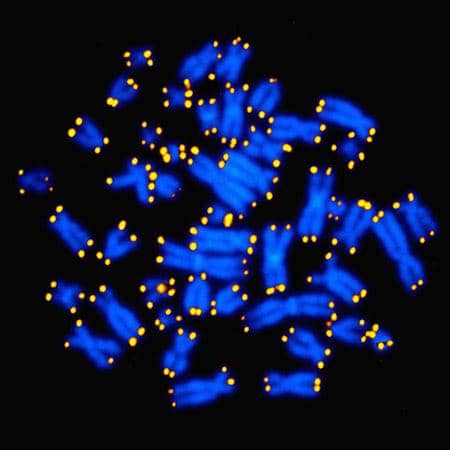 PTSD Linked to Accelerated Aging