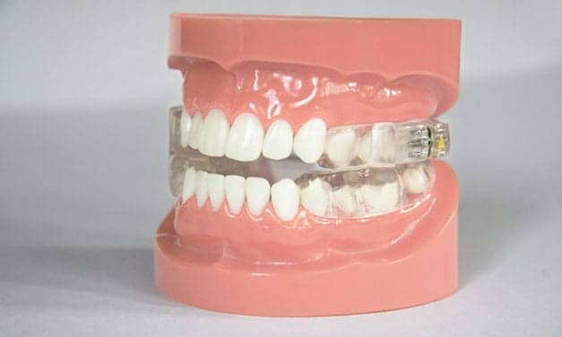Oravan Dental Device for Obstructive Sleep Apnea