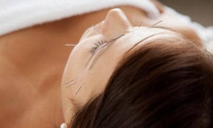 Insomnia Vanquished with Acupuncture and Herbs