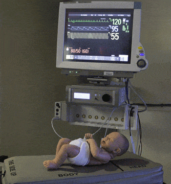Clinical Trial Demonstrates Effectiveness of Infant Apnea Prevention Technology