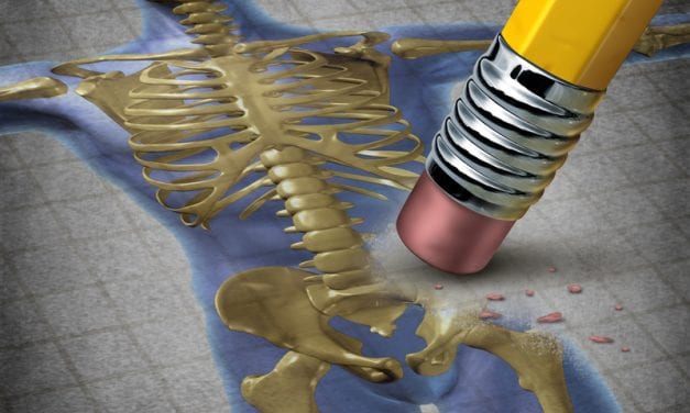 Obstructive Sleep Apnea Raises Osteoporosis Risk, May Impact Bone Health