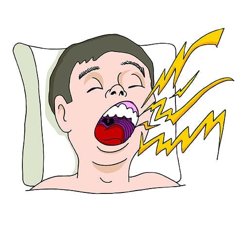 Oral Appliance Therapy: Challenges, Solutions, and a Suggested Decision Tree