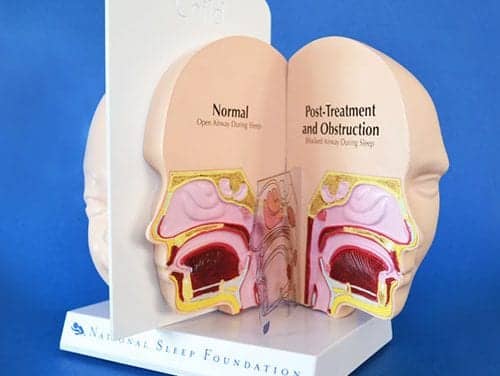 NSF 3D Pediatric Model Aids in Sleep Education