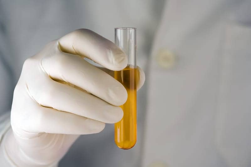 Health Connexions Partners with Serenium to Bring Urine Test for Sleep Apnea to Market