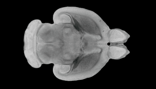 Enhancing Sleep After Brain Injury Reduces Brain Damage and Cognitive Decline in Rats