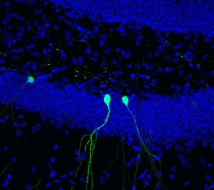 Adult Brain Prunes Branched Connections of New Neurons