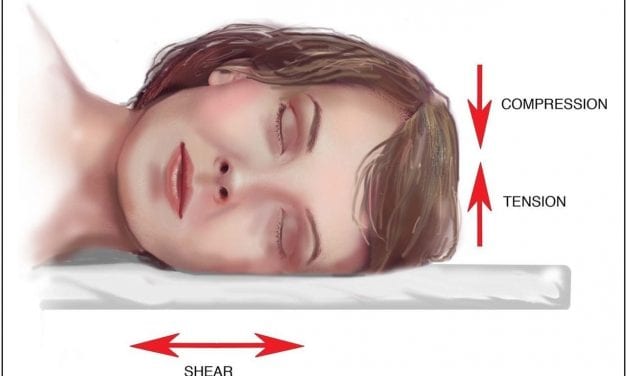 Study Shows Stomach, Side Sleeping Positions Cause Facial Distortion, Wrinkles Over Time