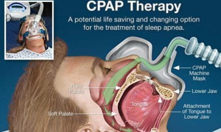 How to Fix Common CPAP Problems