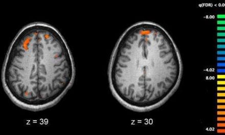 Link Between Schizophrenia and Sleep Apnea