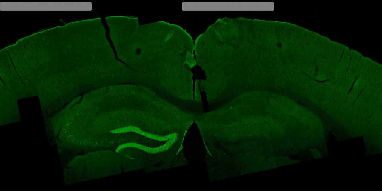 New Electrical Brain Stimulation Technique Shows Promise in Mice