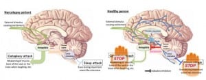 cataplexyserotonin
