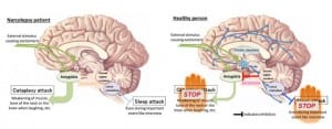 cataplexyserotonin