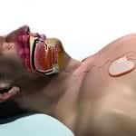 Medicare Contractors Support Use of Inspire’s Sleep Apnea Device