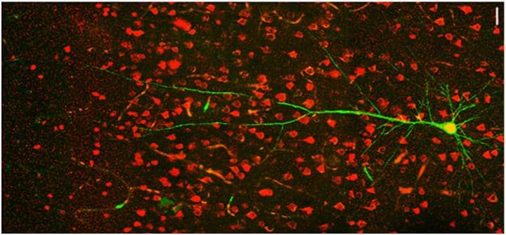 Lack of CLOCK Protein Appears Key in Severe Epilepsy Forms; Effect Stronger During Sleep