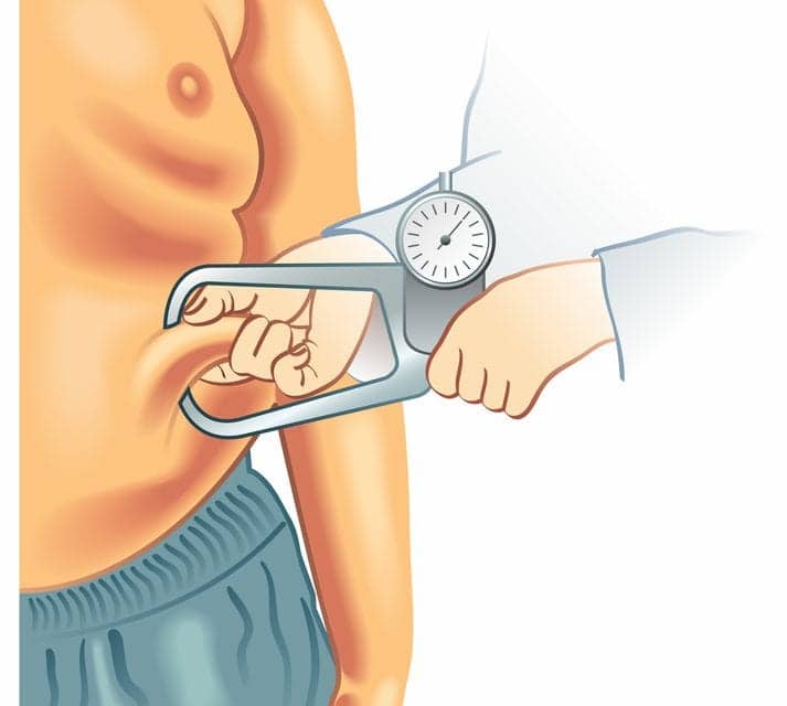 Inefficient Sleep, Physical Inactivity Exacerbate Genetic Risk of Obesity