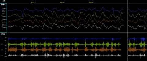Mouse Study Finds Age-disrupted Sleep Is Not Caused by Individual Neuron Activity