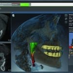 Does Cone Beam Computed Tomography Make Sense in Your Dental Practice?