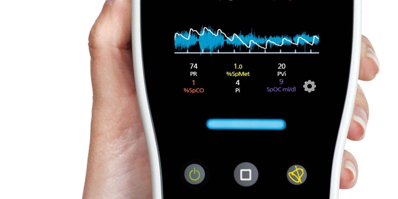 New Study Investigates Utility of Pulse Oximetry to Screen Children with Down Syndrome for Risk of Obstructive Sleep Apnea Prior to Diagnostic Multichannel Sleep Studies