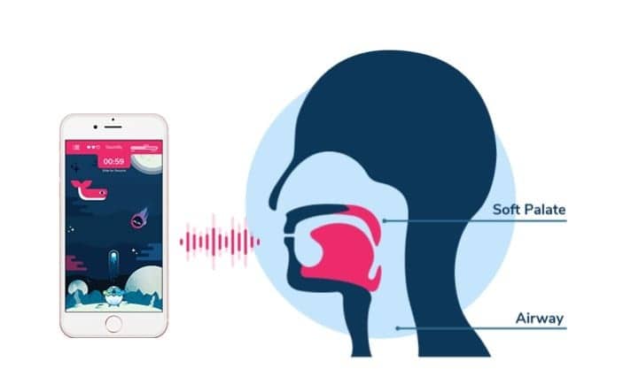 Sleep Clinic-partnered Smartphone App Reduces Snoring