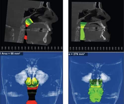 “Airway” Knowledge Has Changed My Diagnosis and Treatment Planning