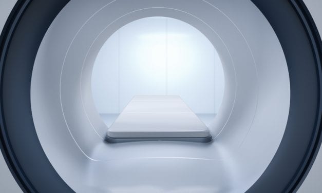 How Does Narcolepsy Change The Brain Over Time?