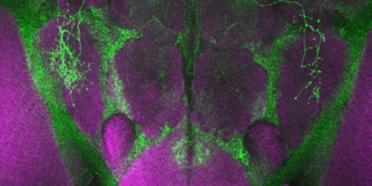 Fruit Fly Study Finds Direct Link Between Illness, Need for More Sleep