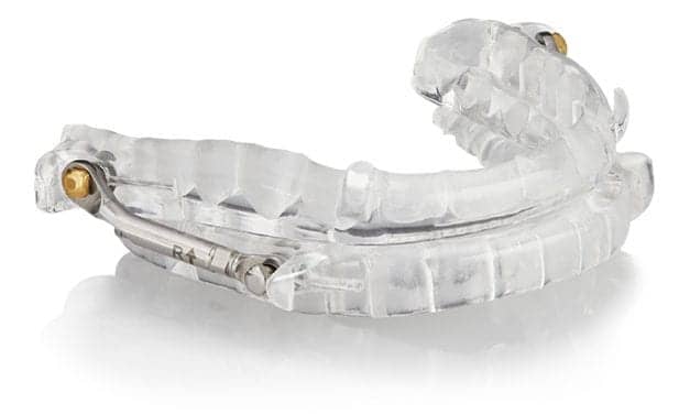 ProSomnus [PH] Precision Herbst-style Sleep Device (PDAC Verified)