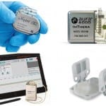 Therapy Update: Implanted Neurostimulators for Sleep Apnea