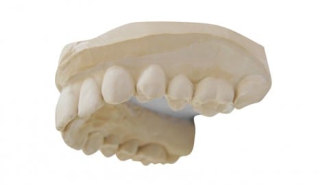 sleep-appliance-teeth-movement