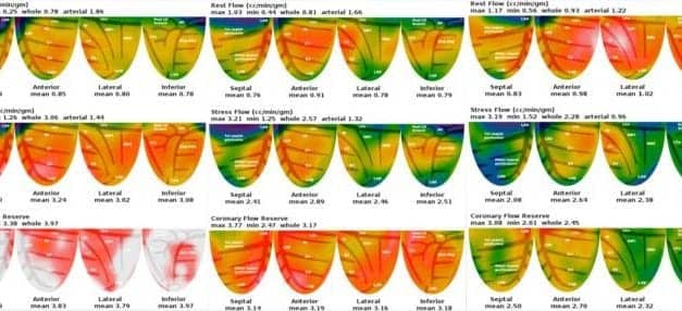 PET/CT Detects Cardiovascular Disease Risk Factors in Obstructive Sleep Apnea Patients