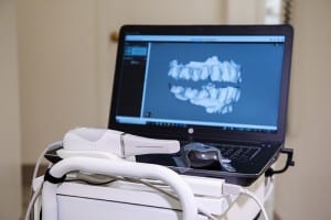 intraoral scanner laptop