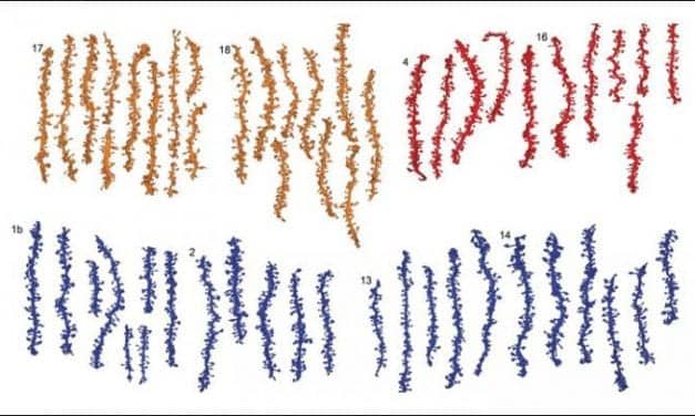 Sleep Readies Synapses for Learning