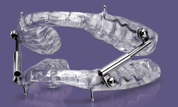 Glidewell Dental Oasys Hinge Appliance (PDAC Approved)