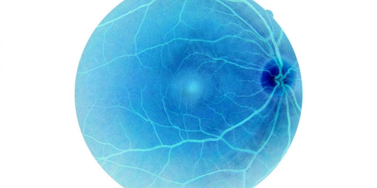 Diabetics with Severe Sleep Apnea at Higher Risk of Blinding Eye Disease