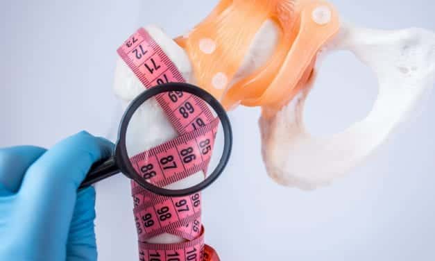 Shortened Sleep May Negatively Affect Women’s Bone Health
