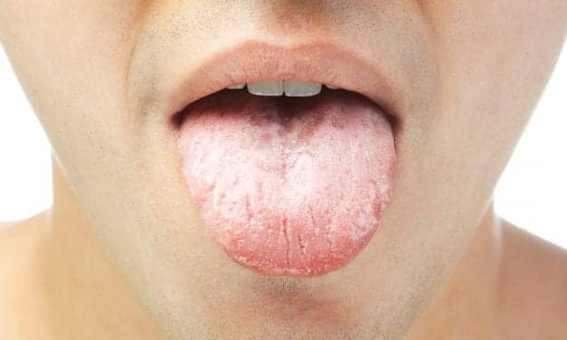We Know Losing Weight Lessens Sleep Apnea Severity. This New Study Helps Explain Why.