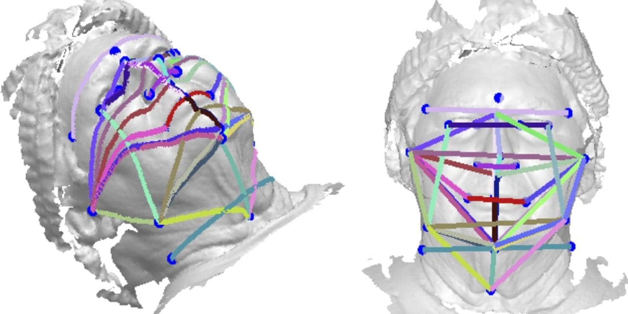 3D Face Photos Could Be a Sleep Apnea Screener
