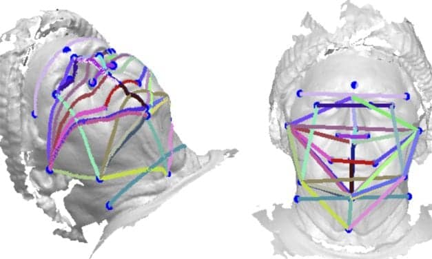 3D Face Photos Could Be a Sleep Apnea Screener